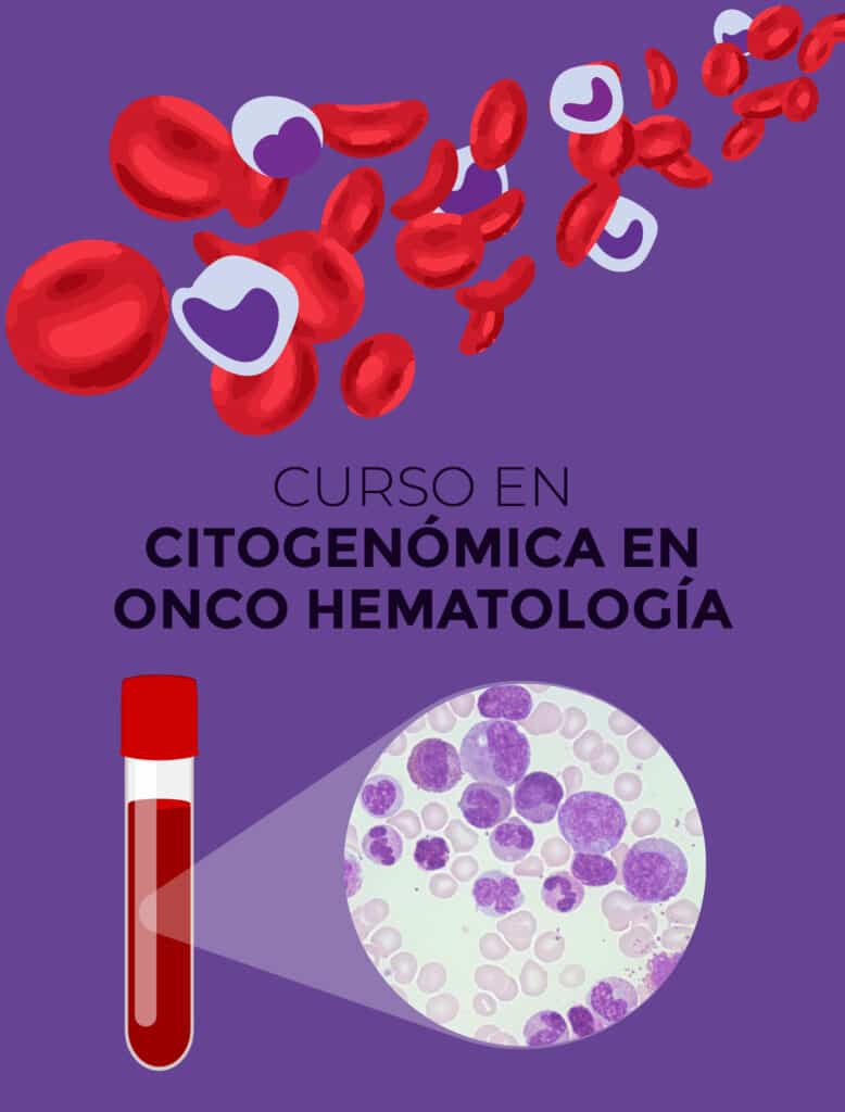 Curso en Citogenómica en Onco Hematología